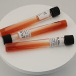 Triple Sugar Iron Agar